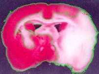 Multifield and recognition — Throughput and AI-style segmentation