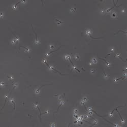 Motility — Tracks, velocities, classification